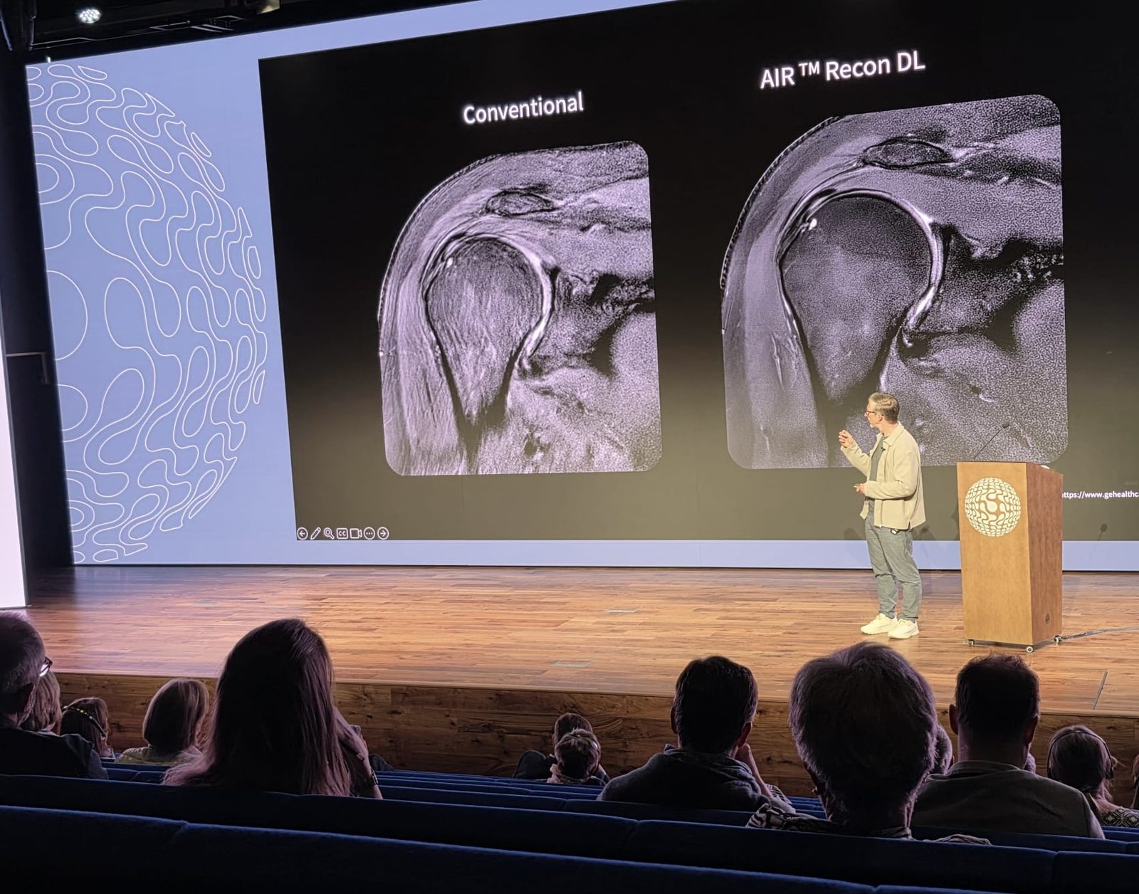 Jan Beger presenting AIR Recon DL MRI image comparison on stage